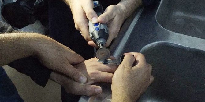 Denemek İçin Taktığı Yüzük Kabusu Oldu
