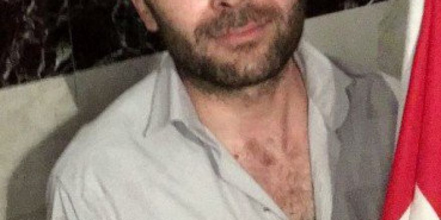 Viranşehir Ak Parti Sosyal İşler Başkanı Tahsin Yolcu Darbeye Karşı Mücadele Verirken Yaralandı