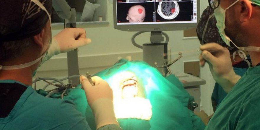 Esogü Hastanesi’nden Yeni Hizmet: Nöronavigasyon Sistemi