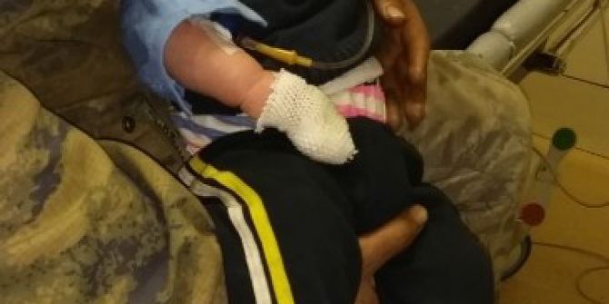 Sobayla Oynayıp Yangın Çıkaran Çocuk Kendisini Ve 2 Kardeşini Yaktı