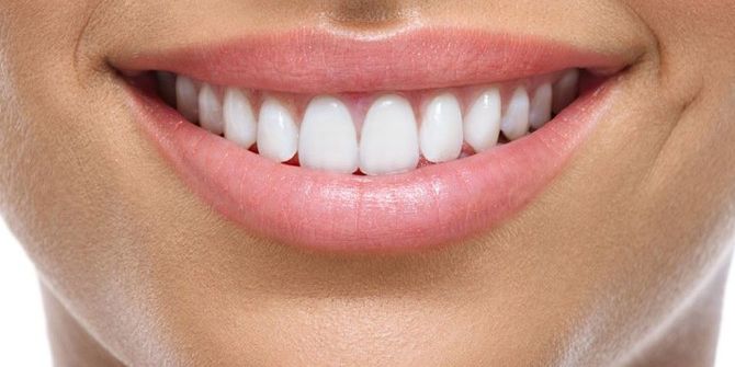 14 Şubat Öncesi Çiftlerde Diş Bakımı Telaşı