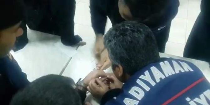 Parmağa Sıkışan Yüzük İtfaiye Ekipleri Tarafından Çıkarıldı