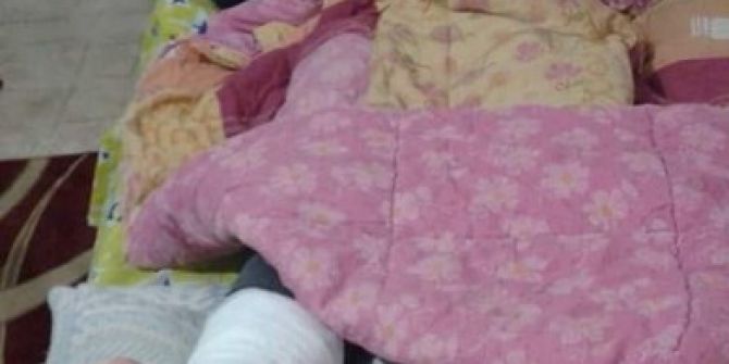 Başkan Bakırlıoğlu Karda Kayıp Düşünce Ayak Bileğinin 3 Yerinde Çatlak Oluştu