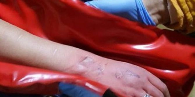 Eli Asansöre Sıkışan Şahsı İtfaiye Kurtardı