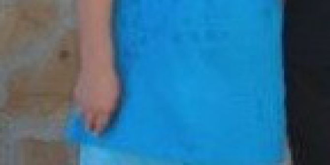 Çocuğunu Kenara İtti, Kendi Aracın Altında Kaldı