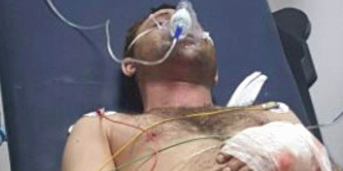 Samsun’da Tüp Patladı: 1 Yaralı