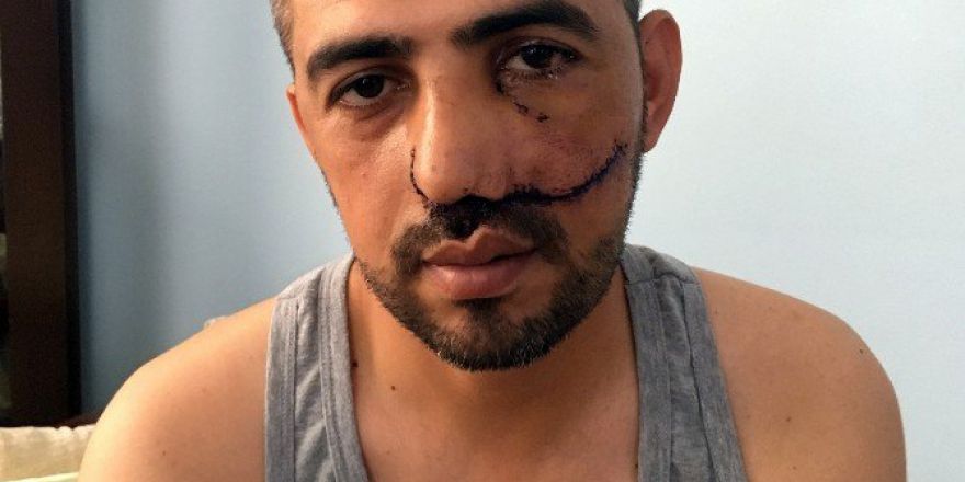 Boğaziçi Köprüsü’nde Yaralanan Hamit Hakan Yılmaztürk, O Anları Anlattı: