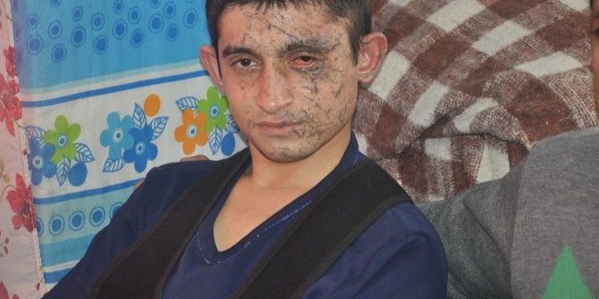 Kayseri Patlaması Gazisi Evine Döndü