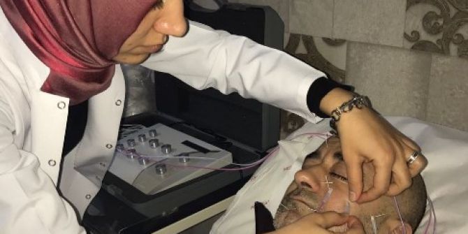 Yüz Felcinde Akupunktur Başarısı