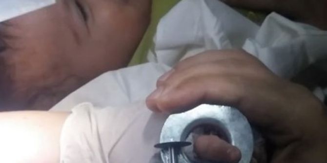 Parmağı Küllüğe Sıkışan Bebeği Afad Ekipleri Kurtardı