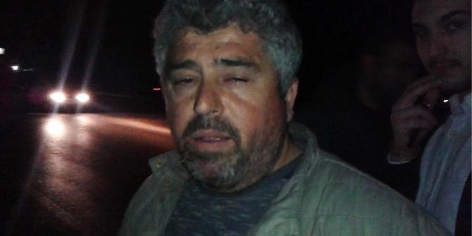 Tilkinin Hayatı İçin Kendi Canını Hiçe Saydı