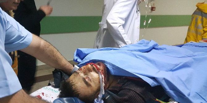 Bıçaklanan Kızı Kurtarmak İsterken Ağır Yaralandı