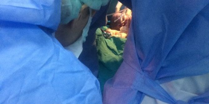 Diyarbakırlı Ailenin Siyam İkizleri Ankara’da Dünyaya Geldi