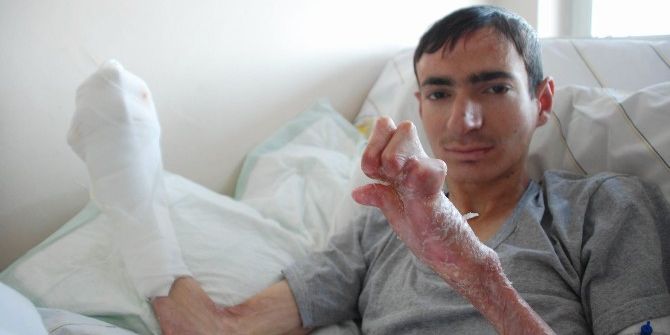 Kapanan Ellerine 5 Yıl Sonra Kavuştu