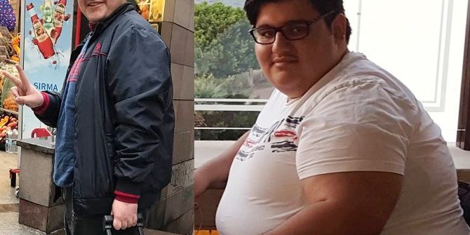 8 Ayda 180 Kilodan 102 Kiloya Düştü