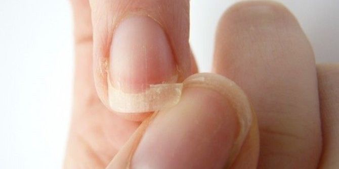 Hamilelikte Tırnaklarda Etkileniyor