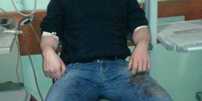 Eski Alaplı İlçe Jandarma Komutanı Çatışmada Yaralandı