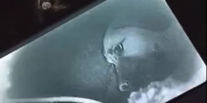 Yavru Köpek Kuyuya Sarkıtılan Kamerayla Görüntülendi