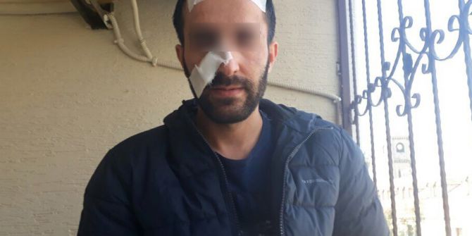 Fuhuş İçin Gittiği Evde Dövülüp Gasp Edildi