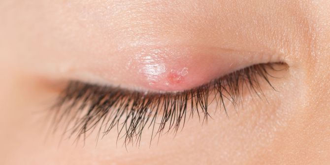 Arpacık İçin Uygulanan Doğru Bilinen Yanlışlar