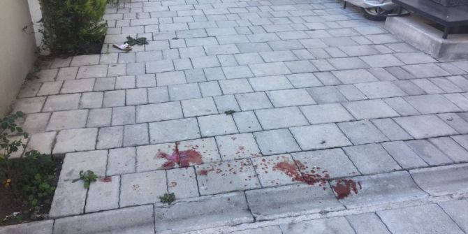 Minik Yürek Yaşama Tutunmaya Çalışıyor