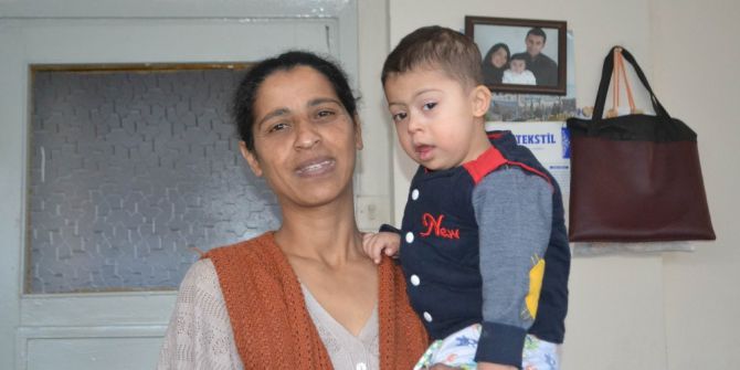 Down Sendromlu 2,5 Yaşındaki Ayaz Bebeğin Ailesi Yardım Bekliyor