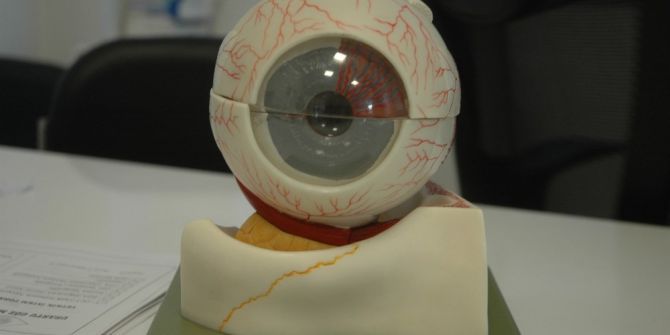 Urartu Göz’de ‘Keratokonus’ Tedavisi