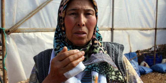 Kavgada Isırılarak Kopartıldığı İddia Edilen Parmak Mahkemeye Taşınıyor