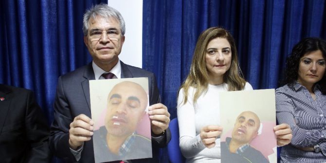 Antalya’da Doktora Demir Çubuklu Darp