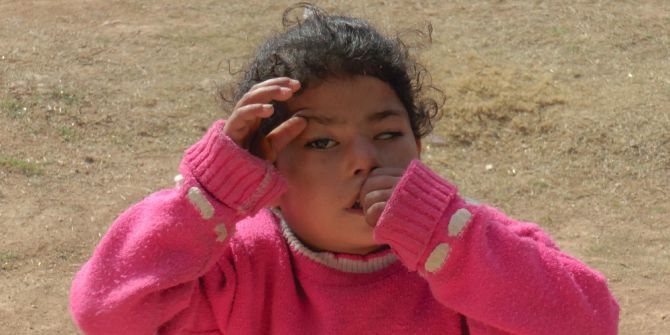 Göz Kapaklarını Parmaklarıyla Açarak Görebiliyor