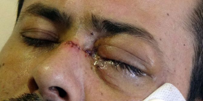 Servisi Beğenmediği İçin Garsonu Bıçaklayan Şahıs Yakalandı