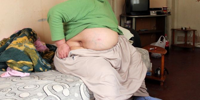 Ayrıldığı Kocası Tarafından 2 Kez Bıçaklanan Kadının Hayatı Karardı