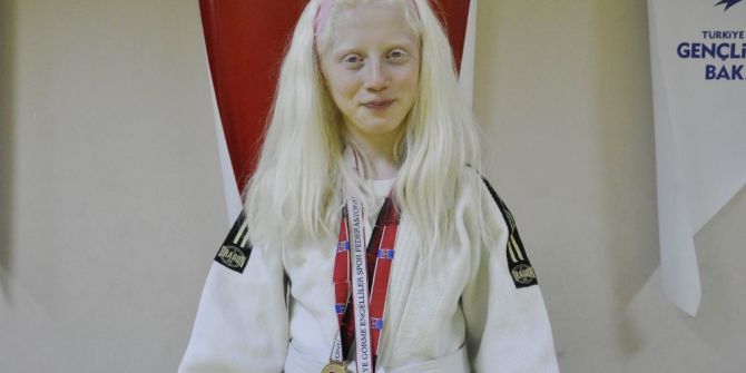 Hem Korkusunu Hem De Rakiplerini Yendi