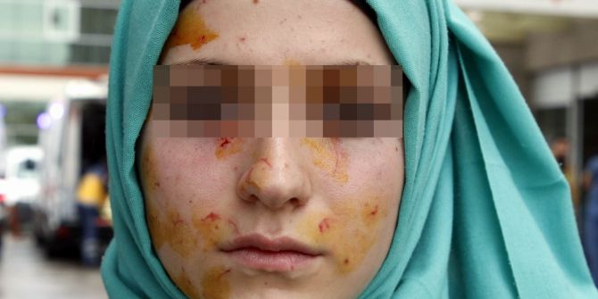 Lise Öğrencilerinin Kavgası Hastanede Bitti