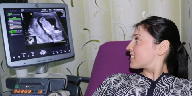 Akupunktur Tedavisi İle Hamile Kaldı