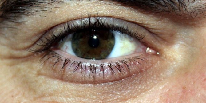 Körlükle Sonlanabilecek Sinsi Hastalık: Glokom