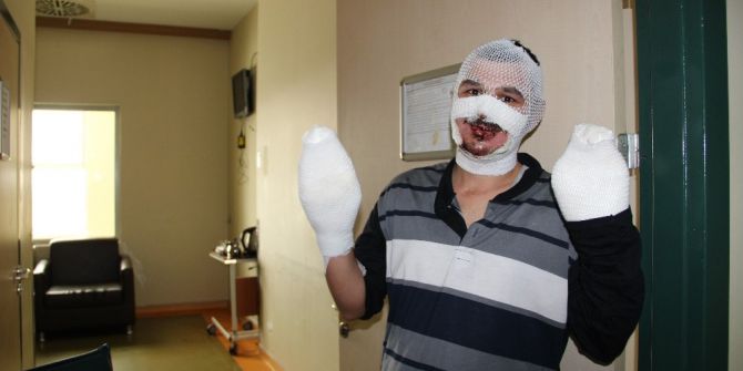 Sobaya Benzin Döktü Yandı