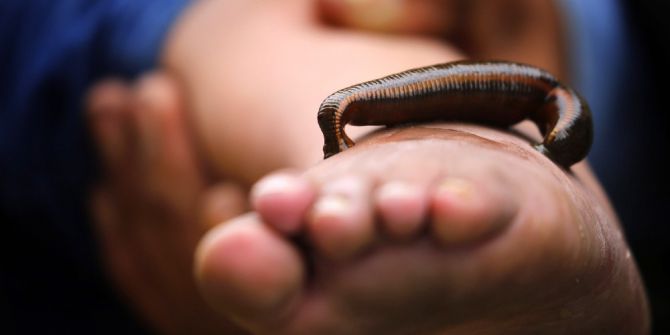 Hindistan’da İlginç Sülük Tedavisi