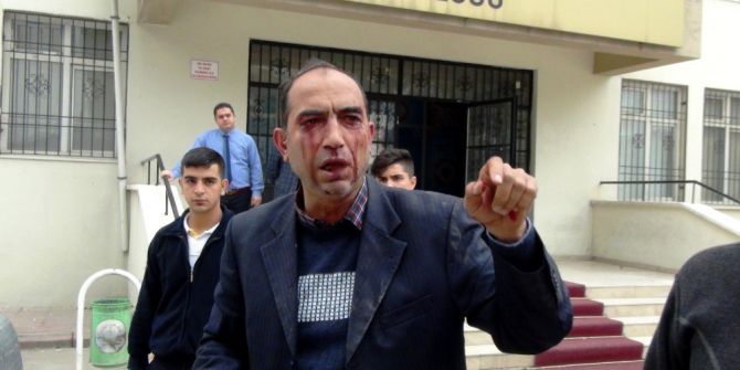 Kantin İhalesinde Silahlar Konuştu: 2 Yaralı