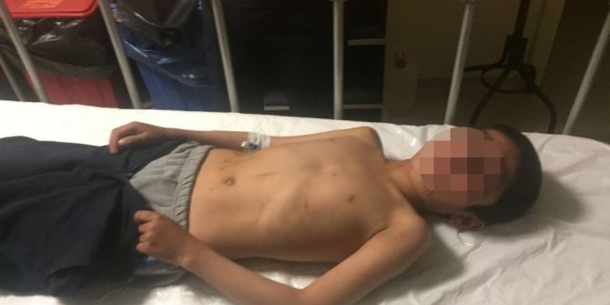 Pazar Yerinde Silahlar Konuştu: 6 Yaralı