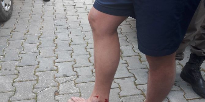 Amatör Maçta Saha Karıştı