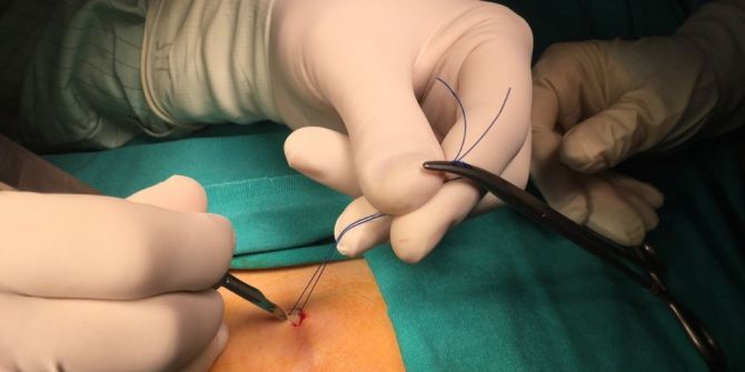 Oturarak Çalışanlarda Kıl Dönmesi Riski Daha Fazla