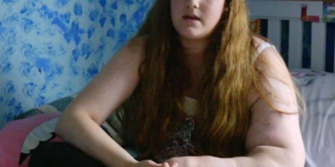 Sol Kolu Hızla Büyüyor