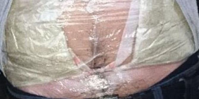 Yolcunun Karnına Sarılı Uyuşturucuyu Polis Buldu