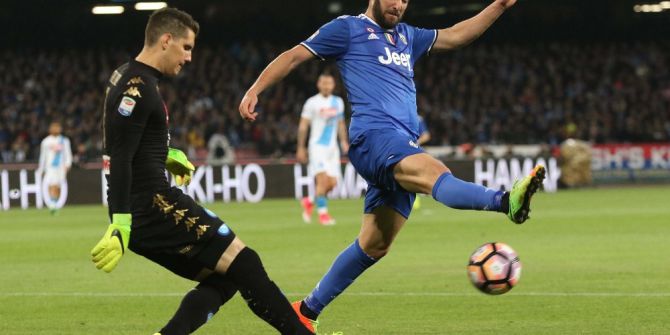 Higuain Görenleri Şaşırttı
