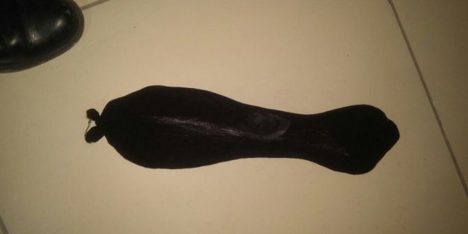 Kasık Bölgesine Sardığı 500 Gram Metamfetaminle Yakalandı