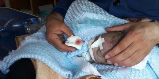 Zehirli Gaz Saldırısında Yaralananlar Türkiye’ye Getiriliyor