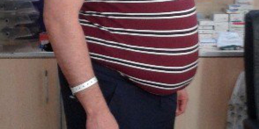 Tüp Mide Ameliyatıyla Diyabetten Kurtuldu