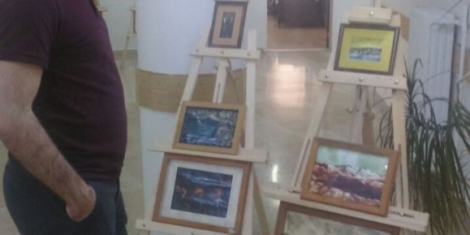 Kanser Hastaları İçin Anlamlı Sergi