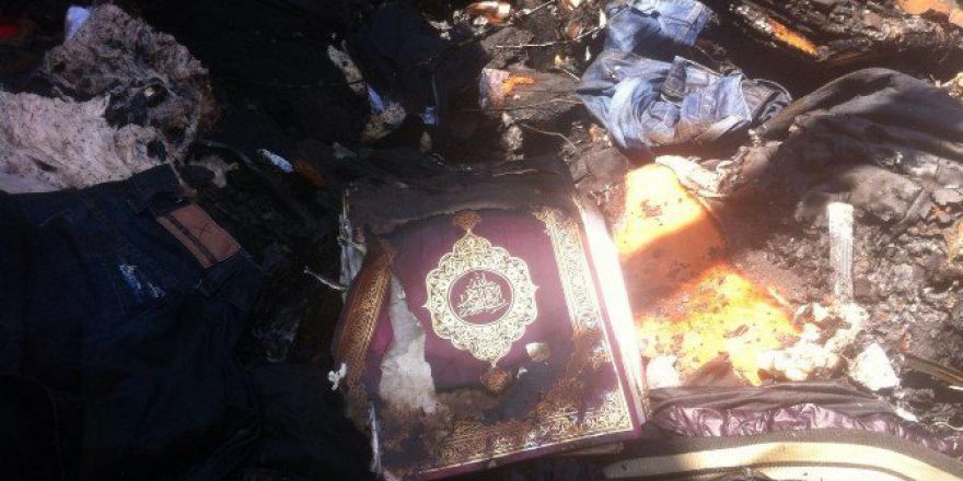 86 Yaşındaki Adam Yandı